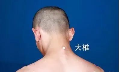 春天灸灸背，能活一百歲~